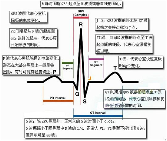 心电图