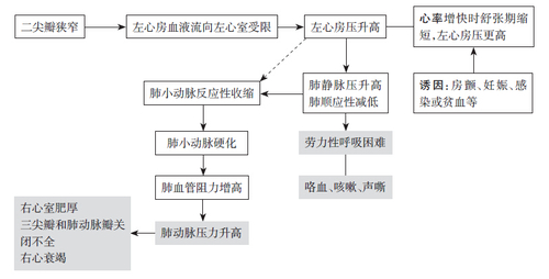 二尖瓣狭窄 二尖瓣狭窄