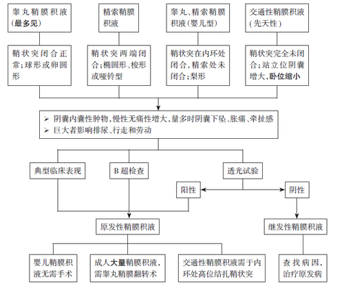 鞘膜积液